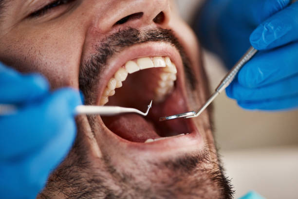 Best 24-Hour Emergency Dentist in Keys, OK