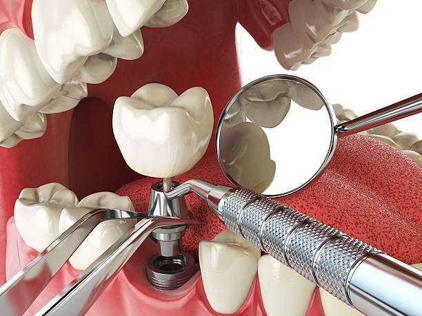 Best Emergency Dental Care for Abscessed Tooth in Keys, OK