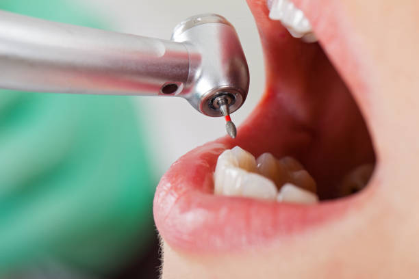 Best Urgent Dental Care for Toothache in Keys, OK